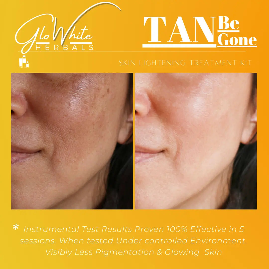 Anti Tan Facial Kit GloWhite Herbals