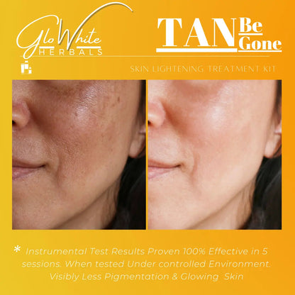 TAN Be Gone skin lightening treatment kit with before-and-after face halves