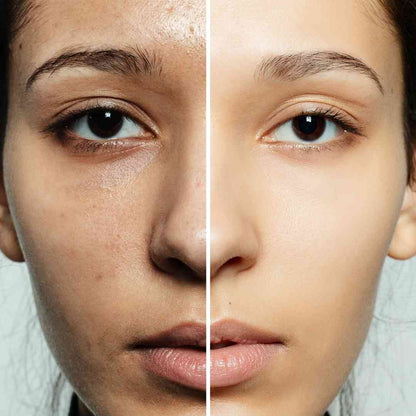 Geteiltes Gesicht: links dunklere Haut, rechts gleichmäßigeres, helleres Hautbild