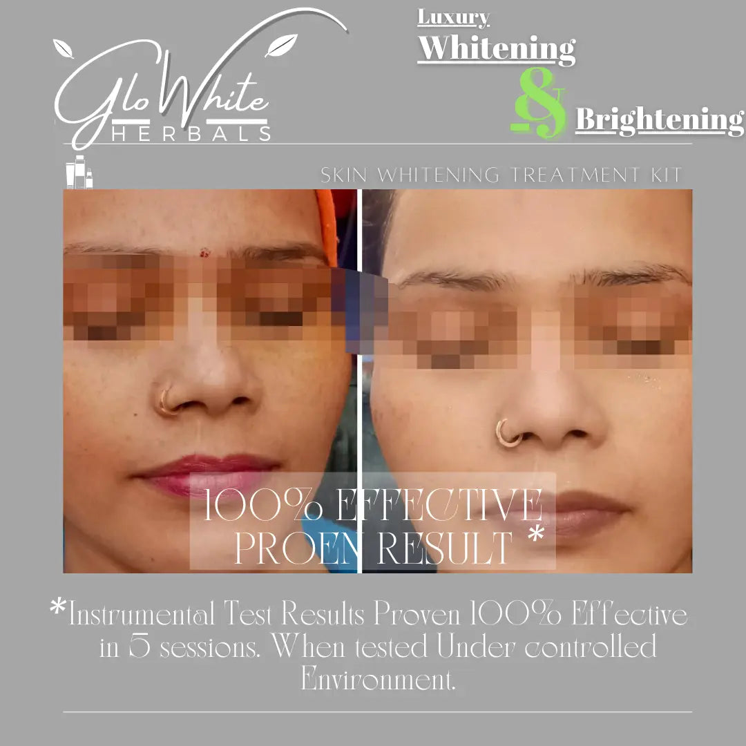 Luxury Whitening & Brightening Facial Kit GloWhite Herbals