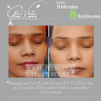 Luxury Whitening & Brightening kit promotion with “100% effective proven result” text